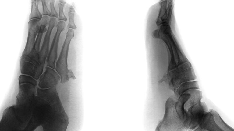 Que révèle ‘La Peau sur les Os’ sur les complexités de la condition humaine ?